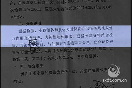 遭后母殴打女童病情恶化公安局尚未立案(图)